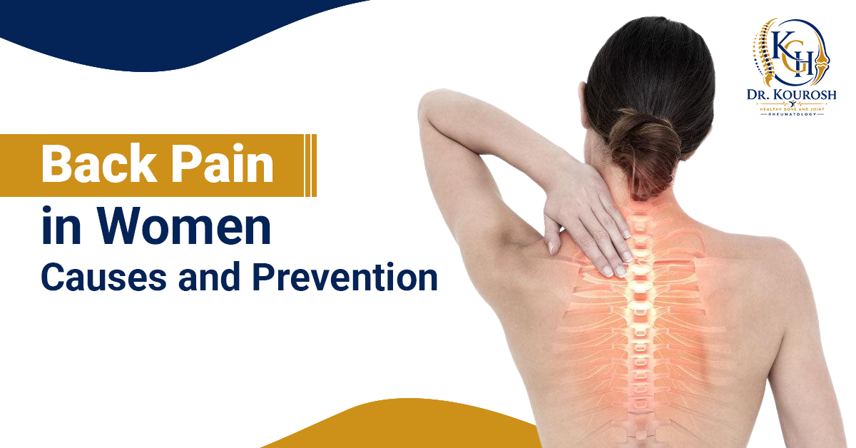 Back Pain in Women