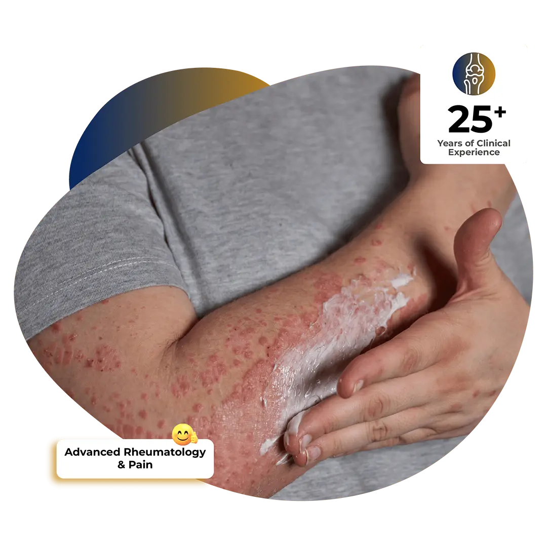 Autoimmune & Rheumatic Disease Treatment
