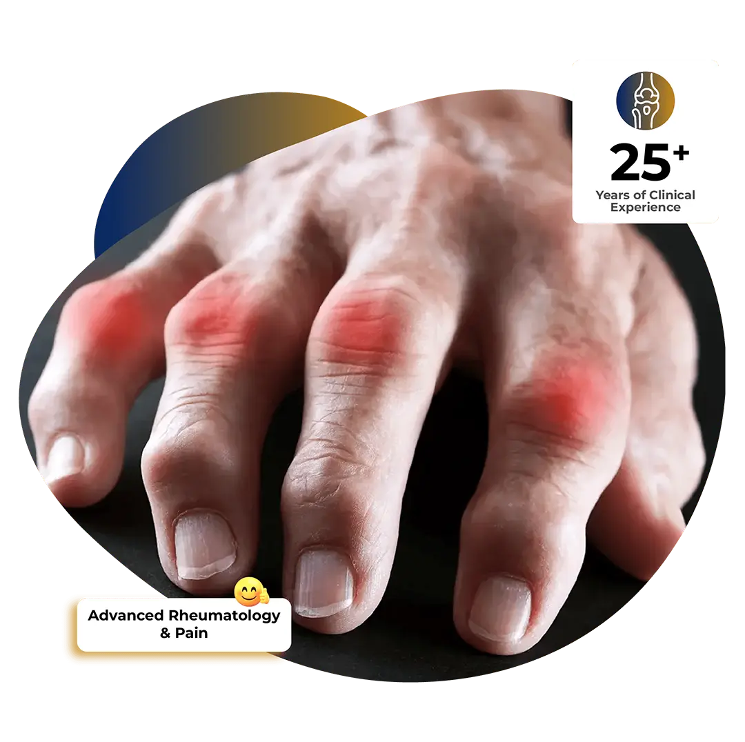 Arthritis Treatment in Dubai